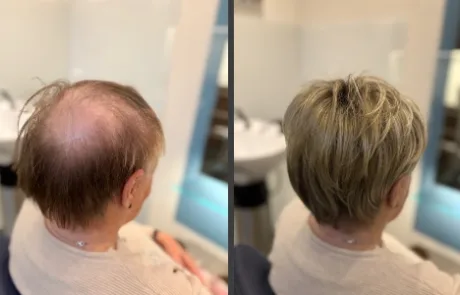 pruiken-limburg-resultaat-136