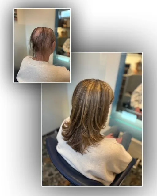 pruiken-limburg-resultaat-voor-en-na-img-105