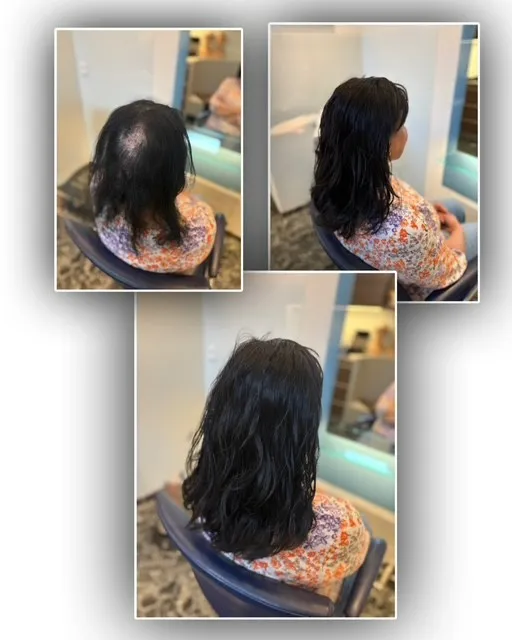 pruiken-limburg-resultaat-voor-en-na-img-106